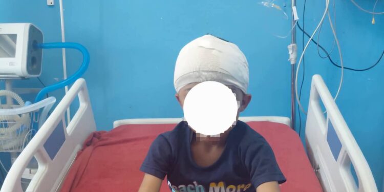 معجزة طبية بسوهاج.. استخراج رصاصة من مخ طفل